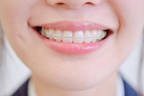 矯正歯科の重要性
